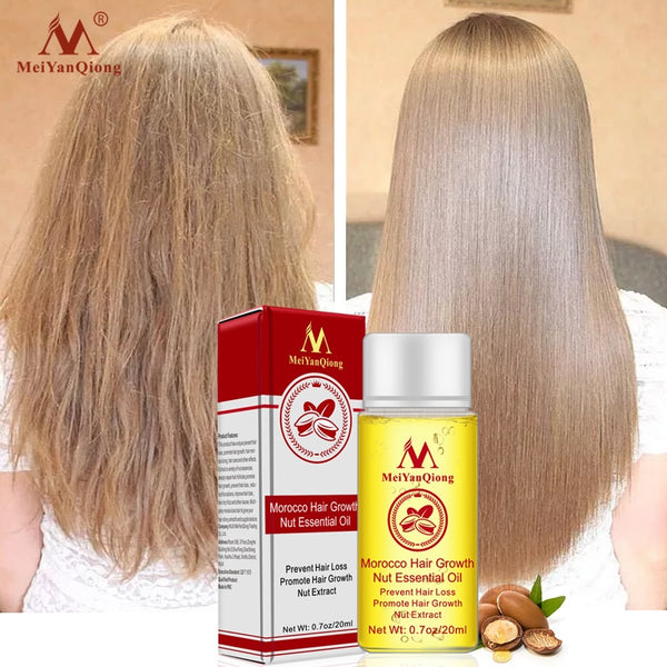 Fast Powerful Hair Growth Essence Hair Loss Products Essential Oil Liquid Treatment Preventing Hair Loss Hair Care Freeshipping